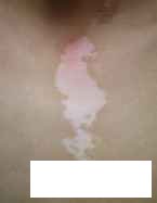 贵州专业看白癜风医院