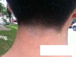 贵州看白癜风医院哪儿快