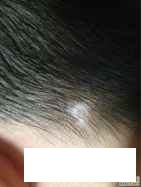 治白癜风贵州医院