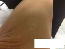 贵州治白癜风的医院