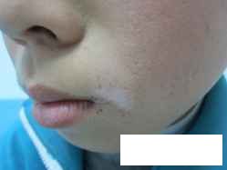 贵州哪家白癜风专科医院口碑较好