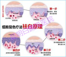 女性白癜风患者怎样调节内分泌?