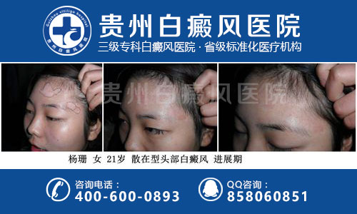 白癜风患者们一般情况下是要注意什么问题