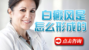 白癜风发病有哪些常见因素